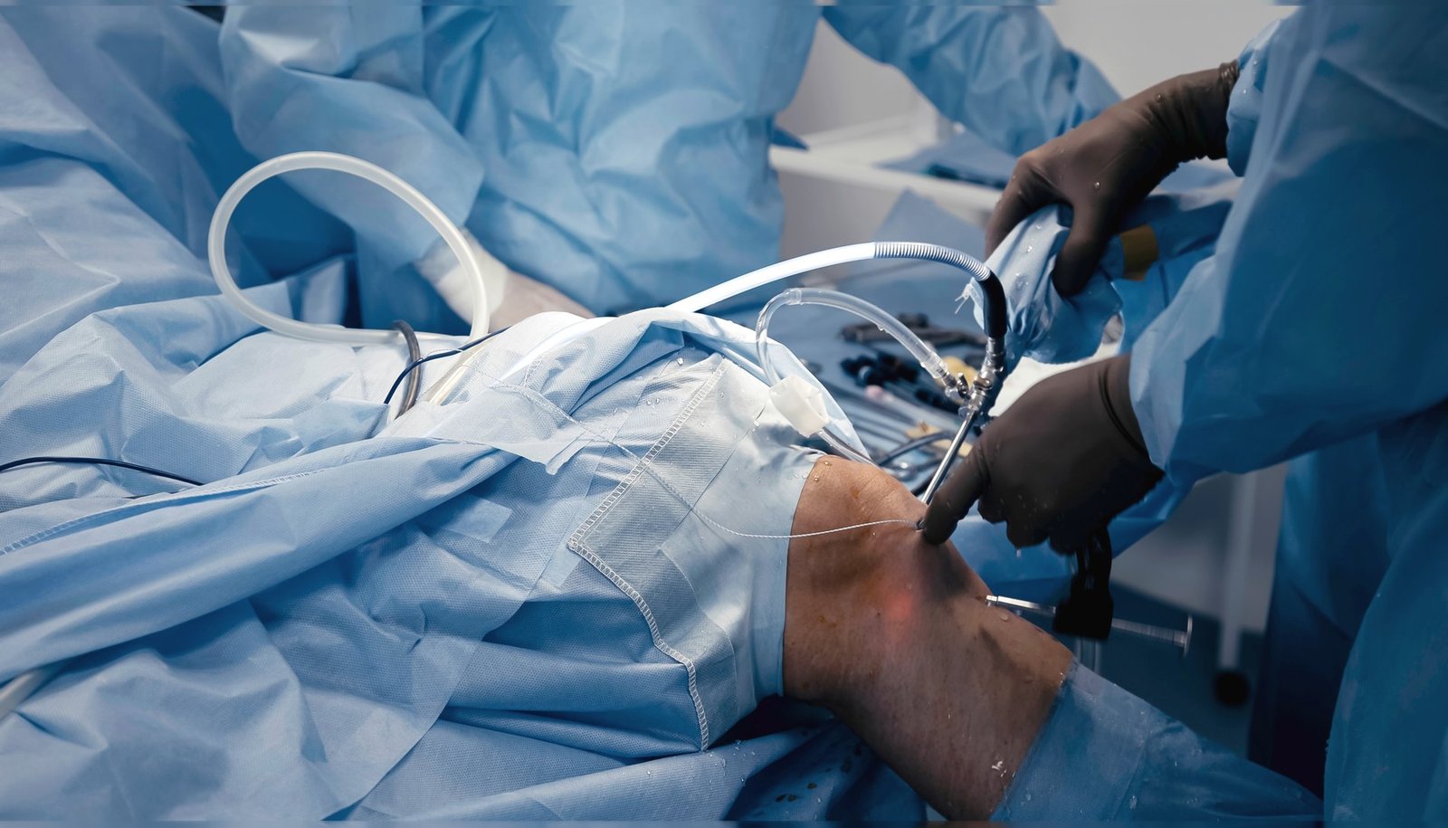 Arthroskopischer Eingriff am Knie
